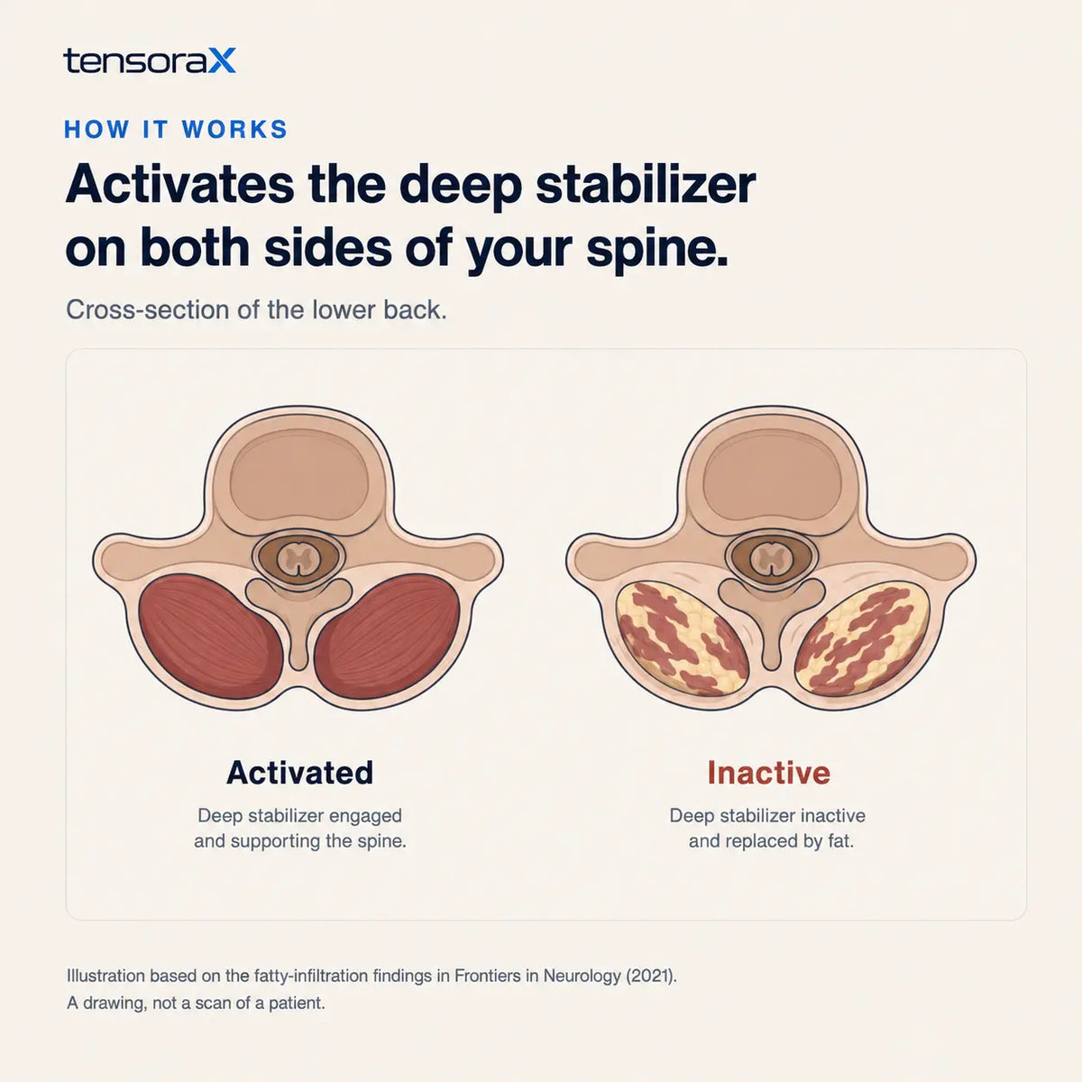 TensoraX™  Adaptive Correction System TensoraX